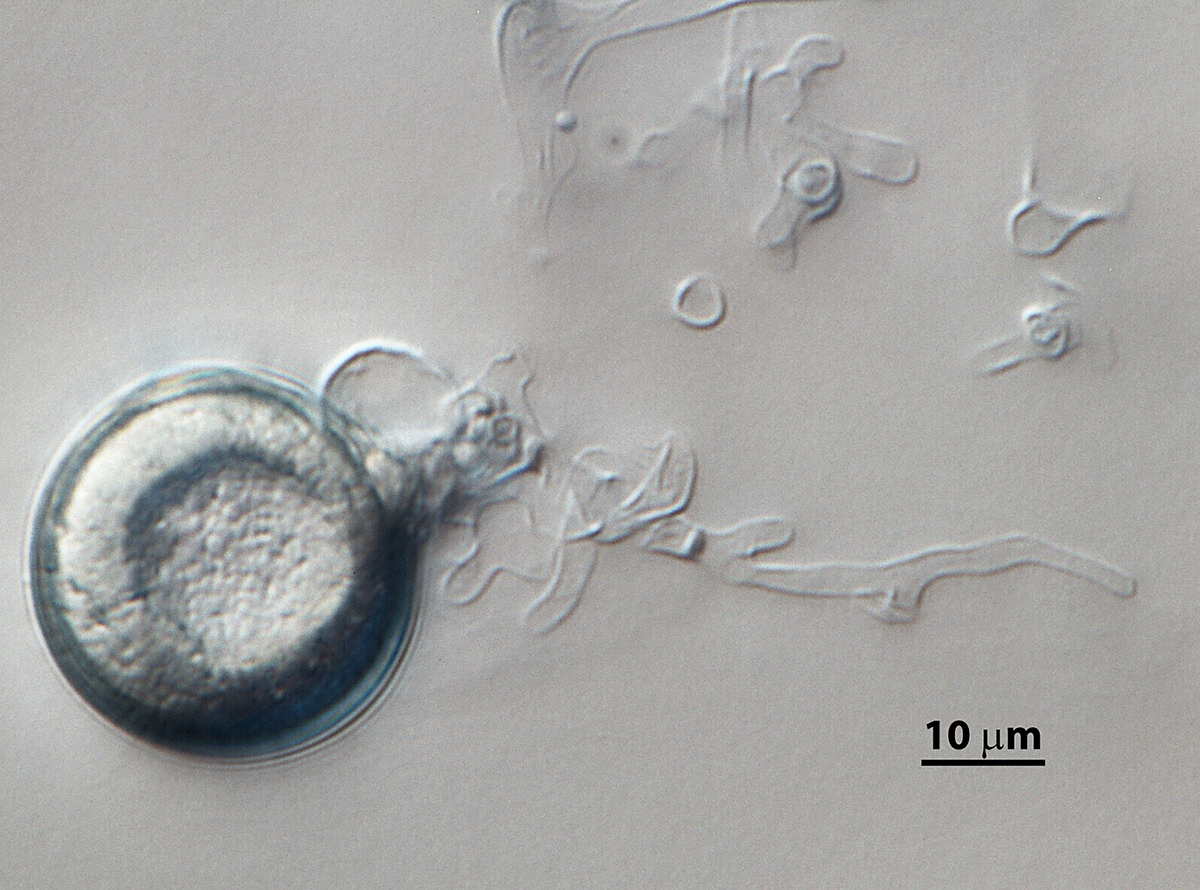   Phytophthora pseudosyringae  (ex-type CPHST BL 51G) sexual phase: slightly aplerotic oospore with paragynous antheridium; photonbsp;by Vickie Brewster, USDA-APHIS-PPQ. 
